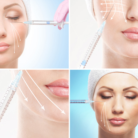 Young woman getting face lifting procedure (collection of some elements)の写真素材
