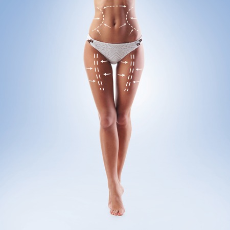 Fat lose, liposuction, sport, fitness, healthy eating, nutrition, fit shape and cellulite removal concept. Woman with arrows on her body.の写真素材