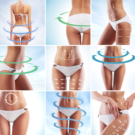 Female body with the drawing arrows. Fat lose, liposuction and cellulite removal concept.の写真素材