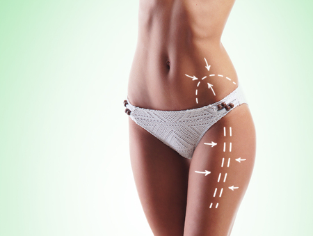 Fat lose, liposuction, sport, fitness, healthy eating, nutrition, fit shape and cellulite removal concept. Woman with arrows on her body.の写真素材