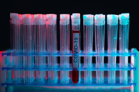 Alert in lab. Scientific laboratory close-up. Pandemic disease, healthcare, vaccine research and coronavirus covid-19 test.の写真素材