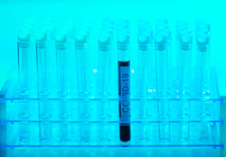 Laboratory tube with blood and virus. Scientific lab close-up. Pandemic disease, healthcare, vaccine...