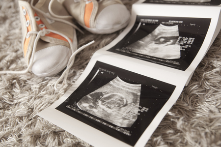 Expecting a baby - conceptual shot of tiny shoes and ultrasonography imageの写真素材