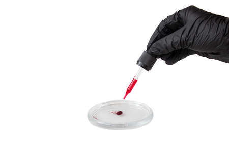 Blood test on a petri dish, a pipette with red liquidの写真素材
