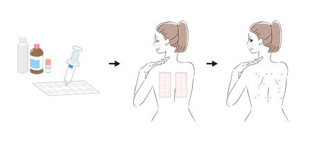 Patch test procedure and woman taking patch testのイラスト素材