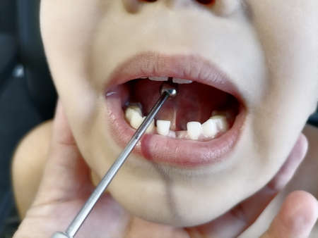 Cute boy child in speech therapist office, teacher's tool helps language move talking close upの写真素材