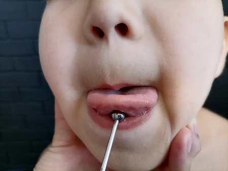 The boy's tongue in the classroom with a speech therapist performs exercises. dyslexia. Using...
