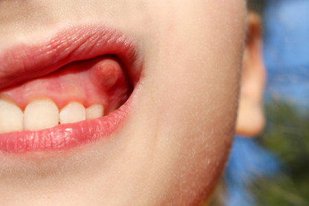 Swelling on gums the child.