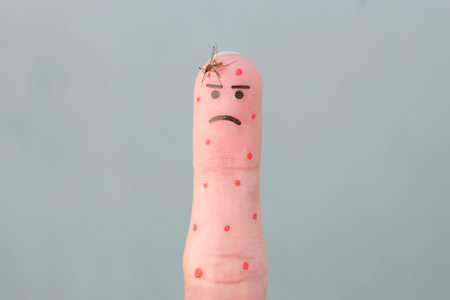 Finger art of man. Concept of human was bitten by mosquito.