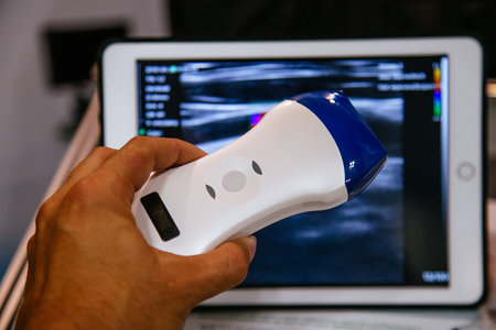 Modern portable ultrasound machine in clinic laboratory of sonography diagnostics.
