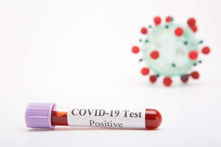 Test tube with a positive COVID-19 test on a white backgroundの写真素材