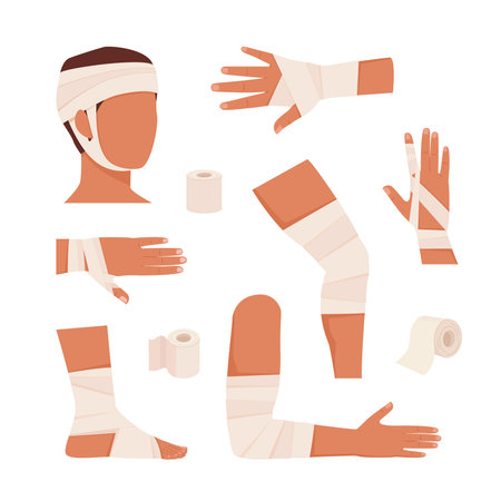 bandaged limbs. cartoon flat injured skin and procedures of bandaging collection, first aid for wound help for human emergency hand trauma. vector cartoon set of isolated objects.のイラスト素材