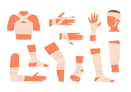 bandaged limbs. first aid for wound help for human emergency hand trauma, cartoon flat injured skin and procedures of bandaging collection. vector cartoon set of isolated objects.のイラスト素材