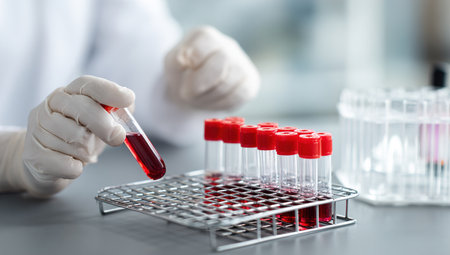 Closeup of scientist hand holding test tube with blood sample in laboratoryの写真素材