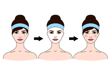 Step-by-step use of facial masks from acne on white background.のイラスト素材