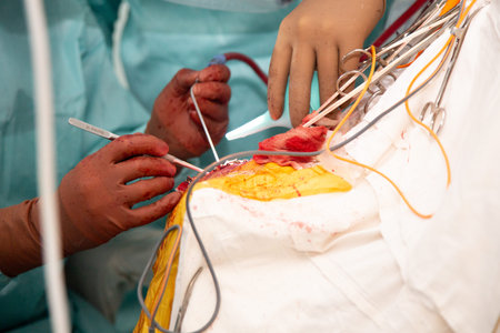Surgeons perform an operation. Real photos from the operation.