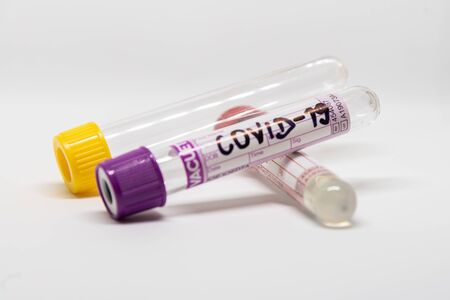 COVID- 19. Corona virus disease. Blood test. Stop dangerous Chinese virus COVID-19.の写真素材