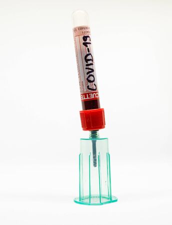 COVID- 19. Corona virus disease. Blood test. Stop dangerous Chinese virus COVID-19.の写真素材