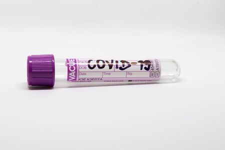 COVID- 19. Corona virus disease. Blood test. Stop dangerous Chinese virus COVID-19.の写真素材