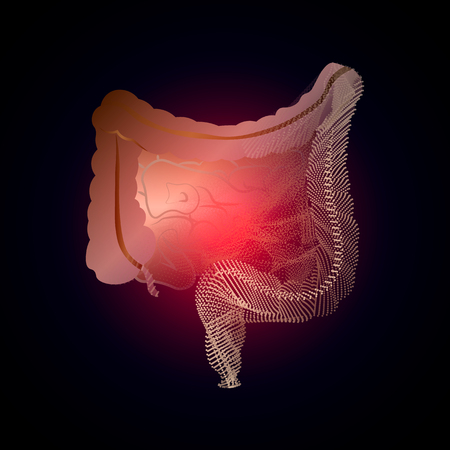 Intestine with a point of pain. Stylized transition from a real organ to an X-ray effect. Medical illustration of intestinal diseasesのイラスト素材