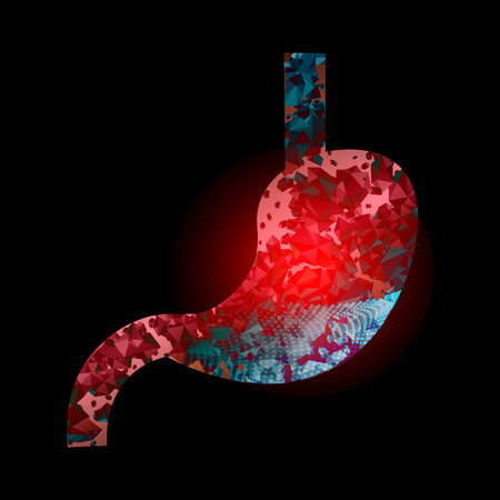 Heaviness in the stomach. Colitis. Medical illustration of stomach diseases.のイラスト素材