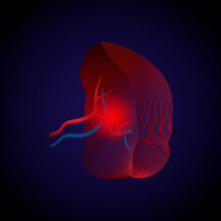 Medical illustration of diseases of the spleen from a real organ to an x-ray effect from lines with a point of inflammation. 10 epsのイラスト素材