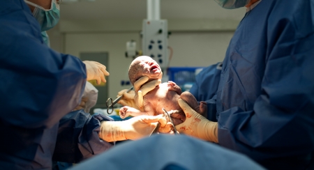 Baby being born via Caesarean Section coming out Baby being born via Caesarean Section coming out