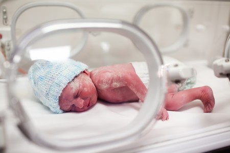 Newborn baby boy covered in vertix in incubatorの写真素材