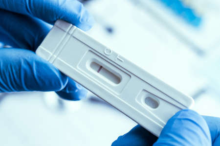 Antigen test antigen coronavirus kit. Laboratory hospital lab background. Doctor holding rapid covid medical test. Patient fast swab serology antibody specimen sampleの写真素材
