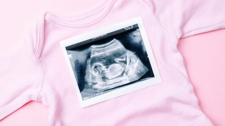 Ultrasound picture pregnant baby photo. Fashion cute baby cloth with ultrasound pregnancy image on...