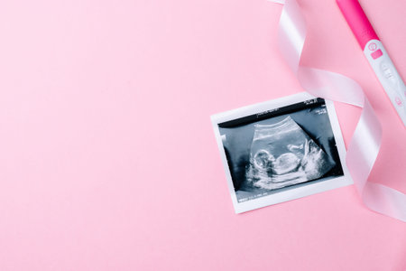 Ultrasound image pregnant baby photo. Fashion cute baby cloth with ultrasound pregnancy picture on...