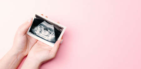 Ultrasound photo pregnancy baby. Woman hands holding ultrasound pregnant picture on pink background. Concept maternity, pregnancy, childbirthの写真素材