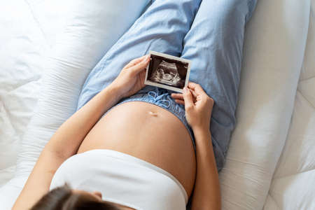 Ultrasound image pregnant baby photo. Woman holding ultrasound pregnancy picture. Pregnancy, medicine, pharmaceuticals, health care and people conceptの写真素材