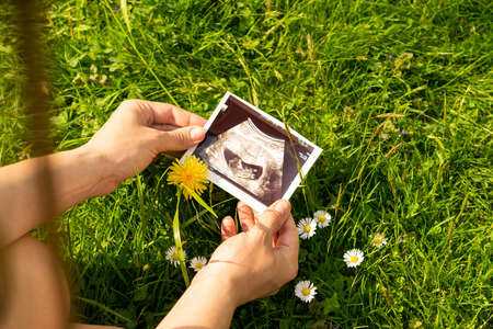 Ultrasound photo pregnancy baby. Woman holding ultrasound pregnant picture on grass flower background. Concept maternity, pregnancy, childbirtの写真素材