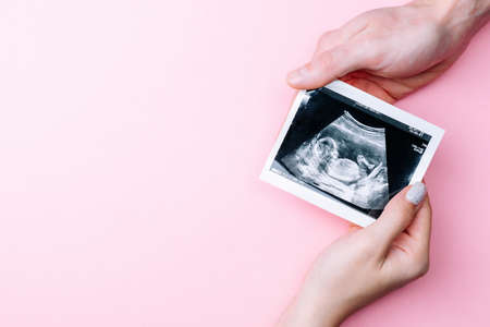 Ultrasound photo pregnancy baby. Woman hands holding ultrasound pregnant picture on pink background. Concept maternity, pregnancy, childbirthの写真素材