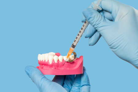 Dentist's hands holding a layout of the human jaw and a syringe with anesthetic.