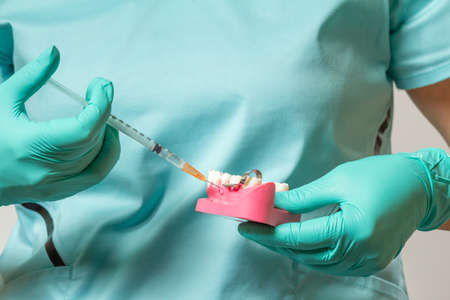 Dentist's hands holding a layout of the human jaw and a syringe with anesthetic.の写真素材