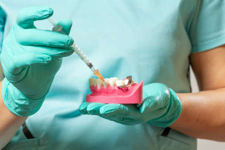 Dentist's hands holding a layout of the human jaw and a syringe with anesthetic.の写真素材