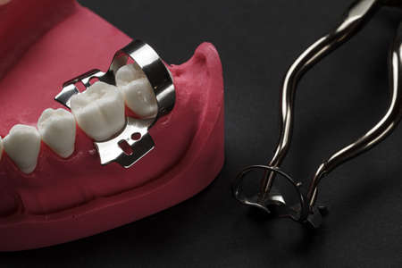 Layout of the human jaw with a dental dam clamp and a rubber dam clamp pliers on the black background. Medical tools concept. Top view.の写真素材