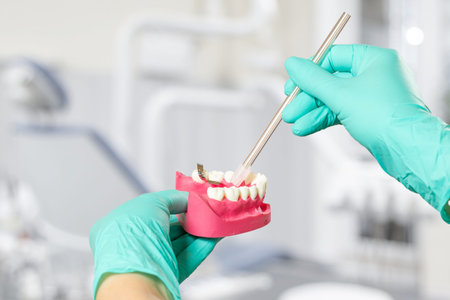 Dentist's hands in latex gloves with the saliva ejector and the human jaw layout. Dental office on...