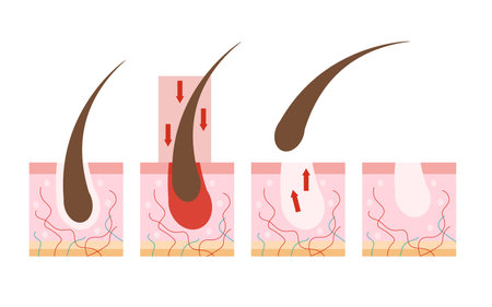 Depilation, a step-by-step method of hair removal. Skin with cut hair - hair removal scheme isolated on white background. Hair loss.のイラスト素材