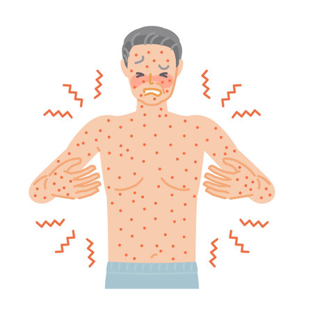 Rash: Senior man suffering from itching and pain all over his body due to hives Rash: Senior man suffering from itching and pain all over his body due to hivesのイラスト素材
