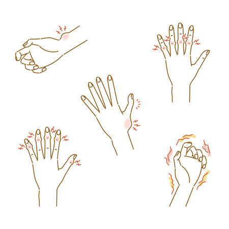 Menopausal disorder in women: illustration set of pain, swelling and deformation of finger jointsのイラスト素材