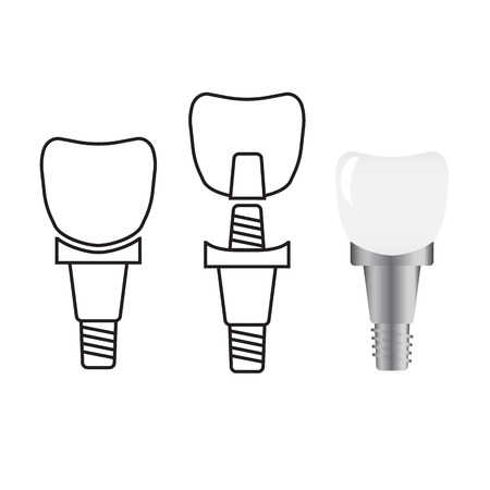 Tooth implant. Implant dental and health toothのイラスト素材