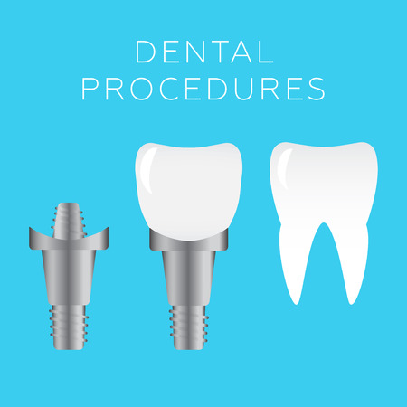 Stomatology and dental procedures vector illustrationのイラスト素材