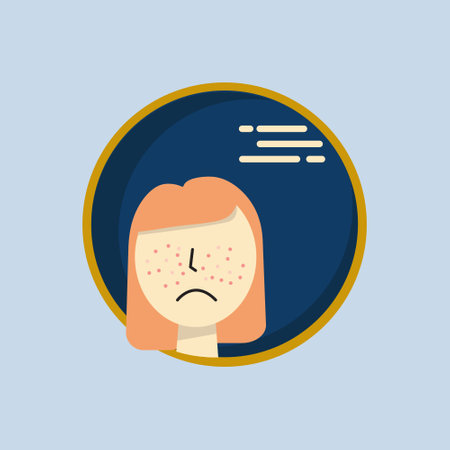 acne, skin problem. Teen acne vector illustration. Young woman. Flat vector design.のイラスト素材