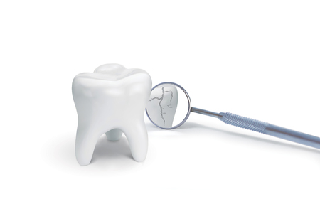Broken tooth with dental mirror on white background. Creative ideaの写真素材