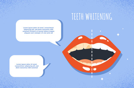 Teeth Whitening conceptのイラスト素材