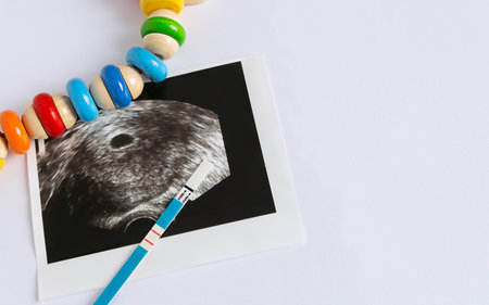 Photo of ultrasound of the first weeks of pregnancy, positive pregnancy test and wooden baby toy on a white background with copy space. Planning and expecting a baby.の写真素材