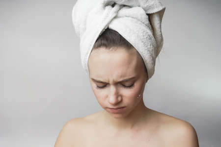 Sad woman in towel, problem skin faceの写真素材